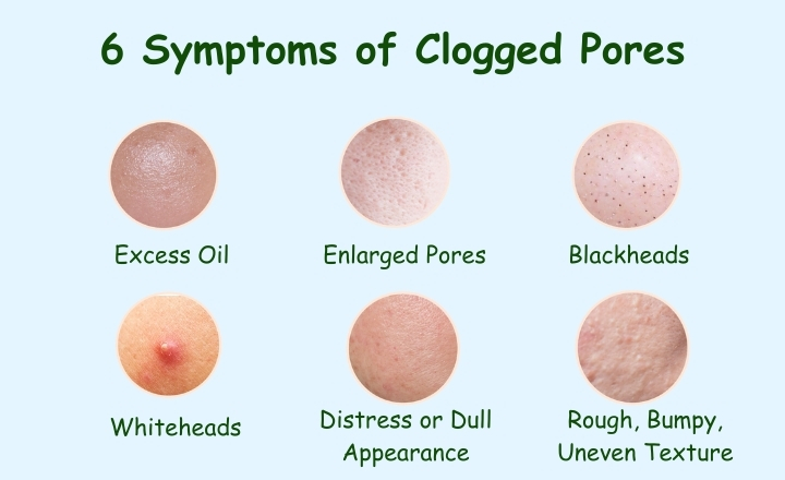 What Do Clog Pores Look Like: 6 Symptoms of Clogged Pores