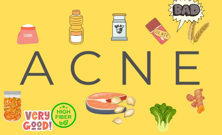 Does Whey Protein Cause Acne?