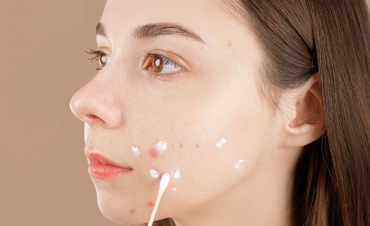 Benefits of Retinoids