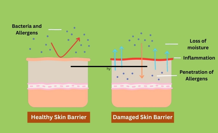 Check your Skin Barriers