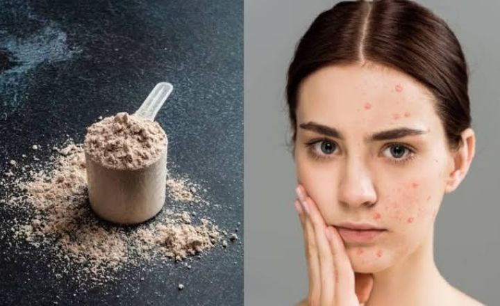 Whey or Vegan Protein Breakouts
