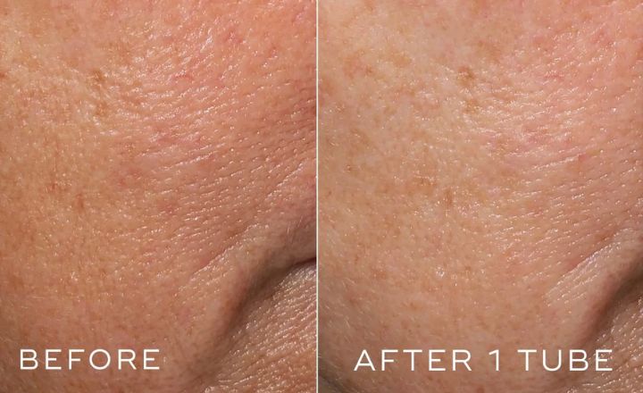 medik8 crystal retinal 3 before and after