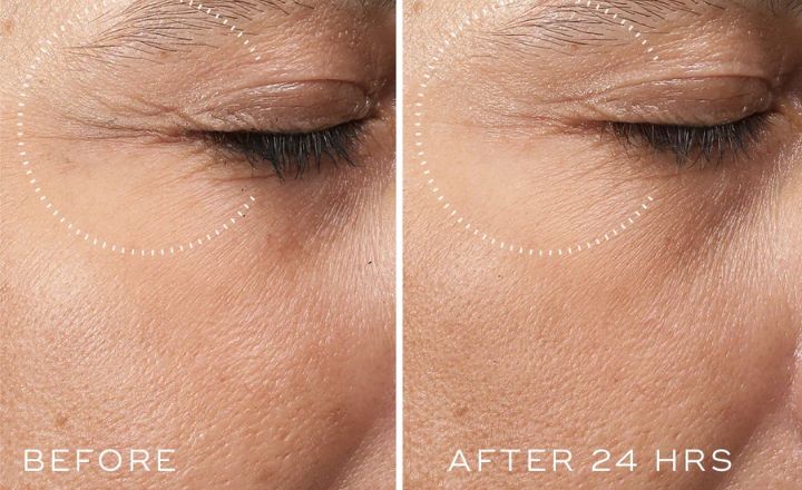 medik8 crystal retinal 6 before and after