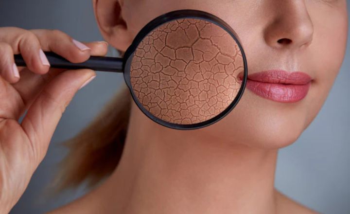 Shield Your Skin Barriers