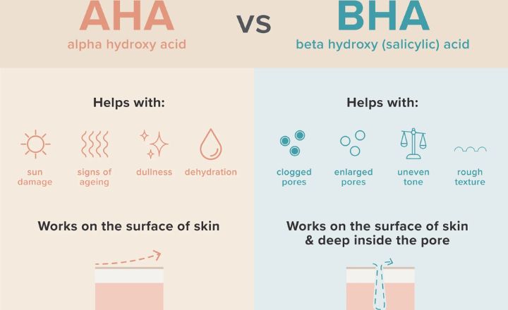 lactic acid vs retinol